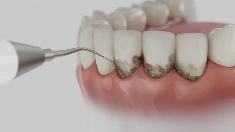 Trusted Root Canal Treatment service in Lowell, MA - Dentist Open Now
